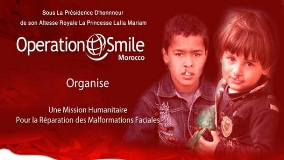 منظمو” عملية بسمة المغرب ” يحلون بأكادير من 30 أكتوبر إلى 19 نونبر 2019 وسيعيدون الابتسامة لأزيد من 200 حالة تعاني من تشوه خلقي والتسجيلات بعين المكان