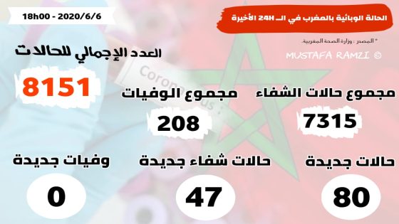 80 إصابة جديدة بكورونا في المغرب و47 حالات شفاء