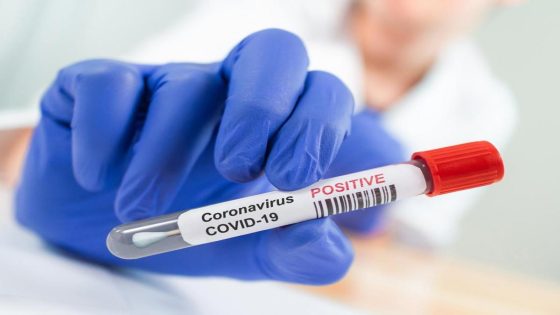 تسجيل 1306  إصابة جديدة بفيروس كورونا بالمغرب